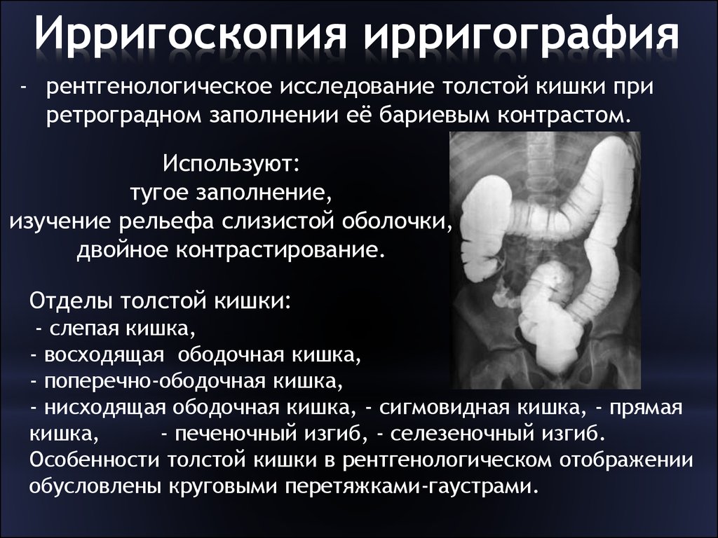 Метод диагностики заболевания толстой кишки изображенный на рисунке